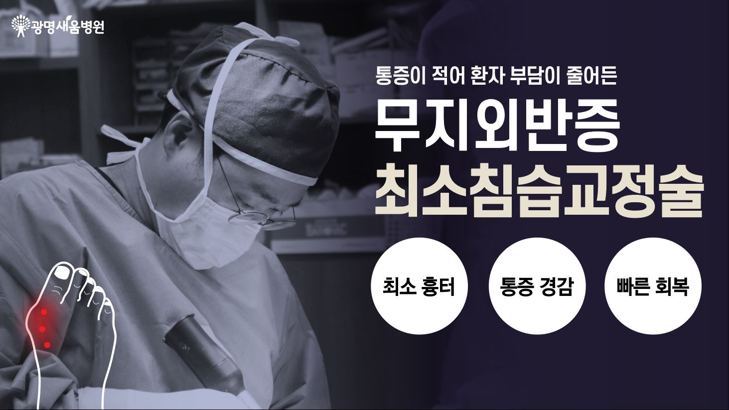 e0f19e42fd43d63a8098524b722f25b5_광명새움병원 무지외반증 최소침습교정술.JPG