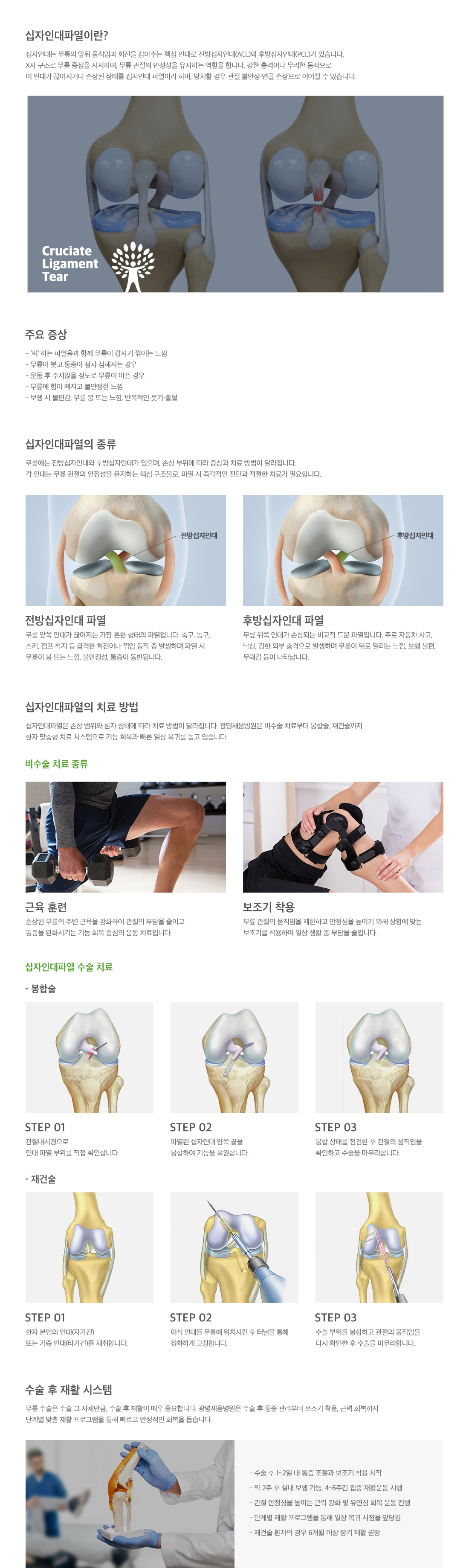 <h3>십자인대 손상</h3> <p>십자인대는 무릎의 앞뒤 움직임과 회전을 잡아주는 핵심 인대로 전방십자인대와 후방십자인대가 있습니다. 강한 충격으로 인해 이 인대가 끊어지거나 손상된 상태를 십자인대 파열이라 하며, 방치할 경우 관절 불안정 또는 연골 손상으로 이어질 수 있습니다. 주요 증상으로는 퍽 하는 파열음과 함께 무릎이 갑자기 꺾이는 느낌이 들고, 무릎이 붓거나 통증으로 인해 아프고 힘이 빠지게 됩니다. 치료 방법으로는 근육 훈련, 보조기 착용, 봉합술, 재건술 등이 있습니다.</p>