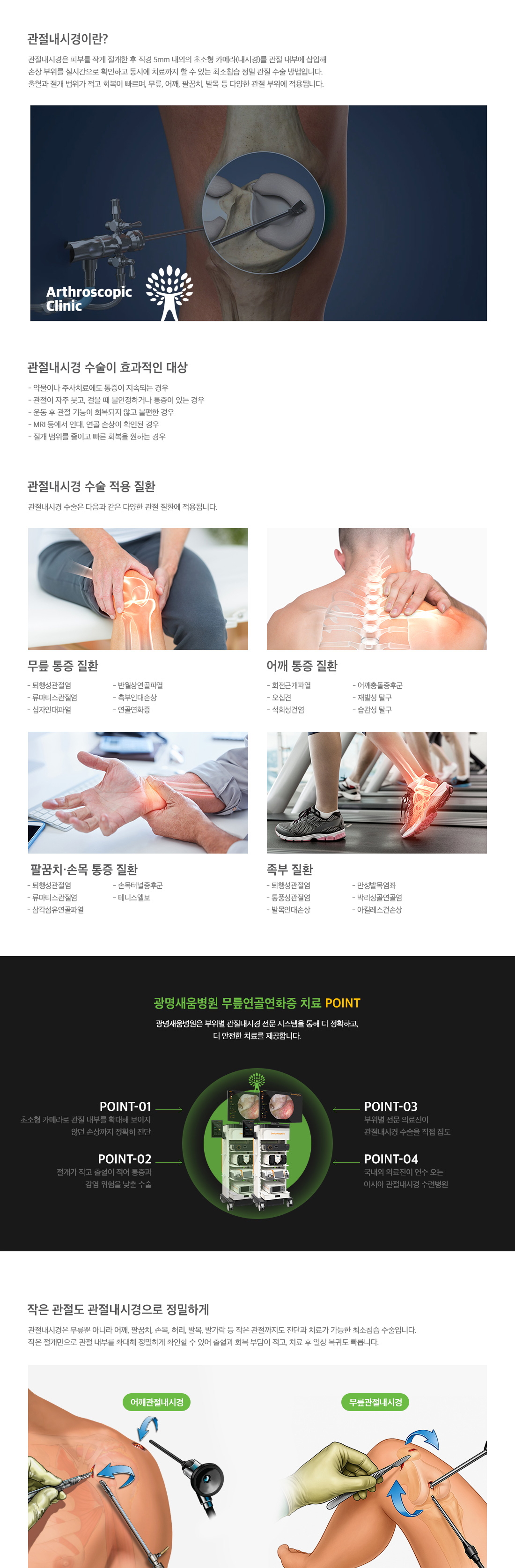 <h3>관절내시경클리닉이란</h3> <p>피부를 작게 절개한 후 직경 5mm 내외의 초소형 카메라(내시경)을 관절 내부에 삽입해 손상 부위를 실시간으로 확인하고 동시에 치료까지 할 수 있는 최소침습 정밀 관절 수술 방법입니다. 출혈과 절개 범위가 적고 회복이 빠르며, 무릎, 어깨, 팔꿈치, 발목 등 다양한 관절 부위에 적용됩니다. 이 수술은 약물이나 주사치료에도 통증이 지속되거나 운동 후 관절 기능이 회복되지 않고 불편한 경우에 효과적입니다.</p>